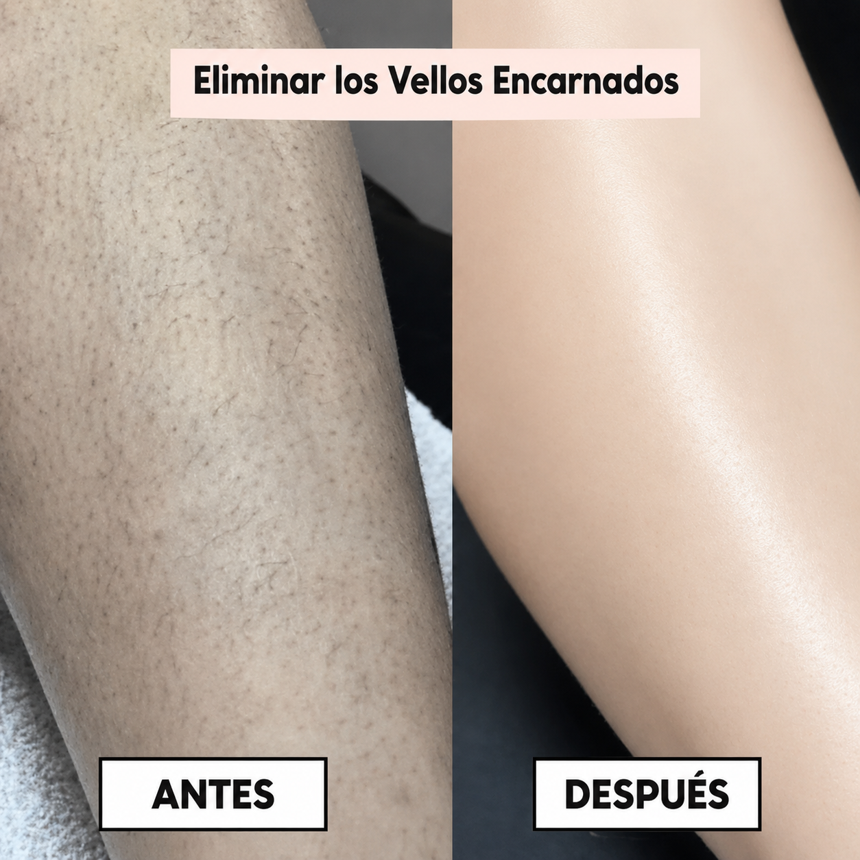 PureSkin™ – Afeitadora eléctrica para mujer
