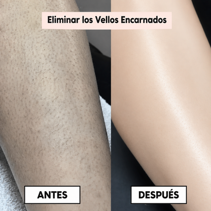 PureSkin™ – Afeitadora eléctrica para mujer